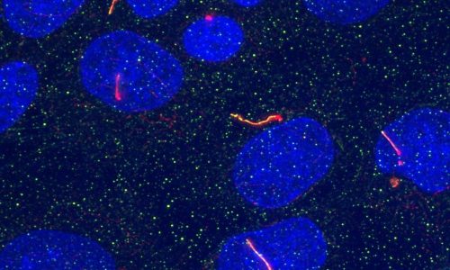 imcd_cilia
